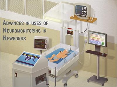 Editorial: Advances in the use of neuromonitoring in newborns